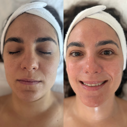 Beige Brown Minimalist Beauty Before After Instagram Story 11