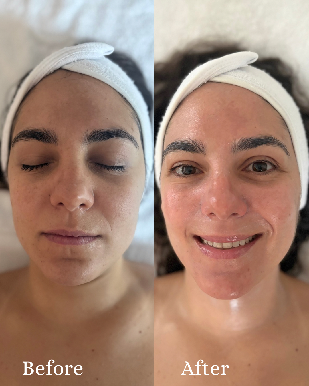 Beige Brown Minimalist Beauty Before After Instagram Story 11