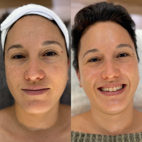 Beige Brown Minimalist Beauty Before After Instagram Story 2