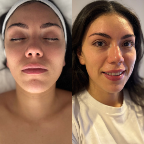 Beige Brown Minimalist Beauty Before After Instagram Story 5