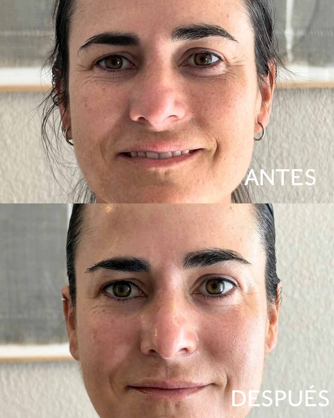 SI, PUEDE ENVEJECER AL REVÉS - 1
