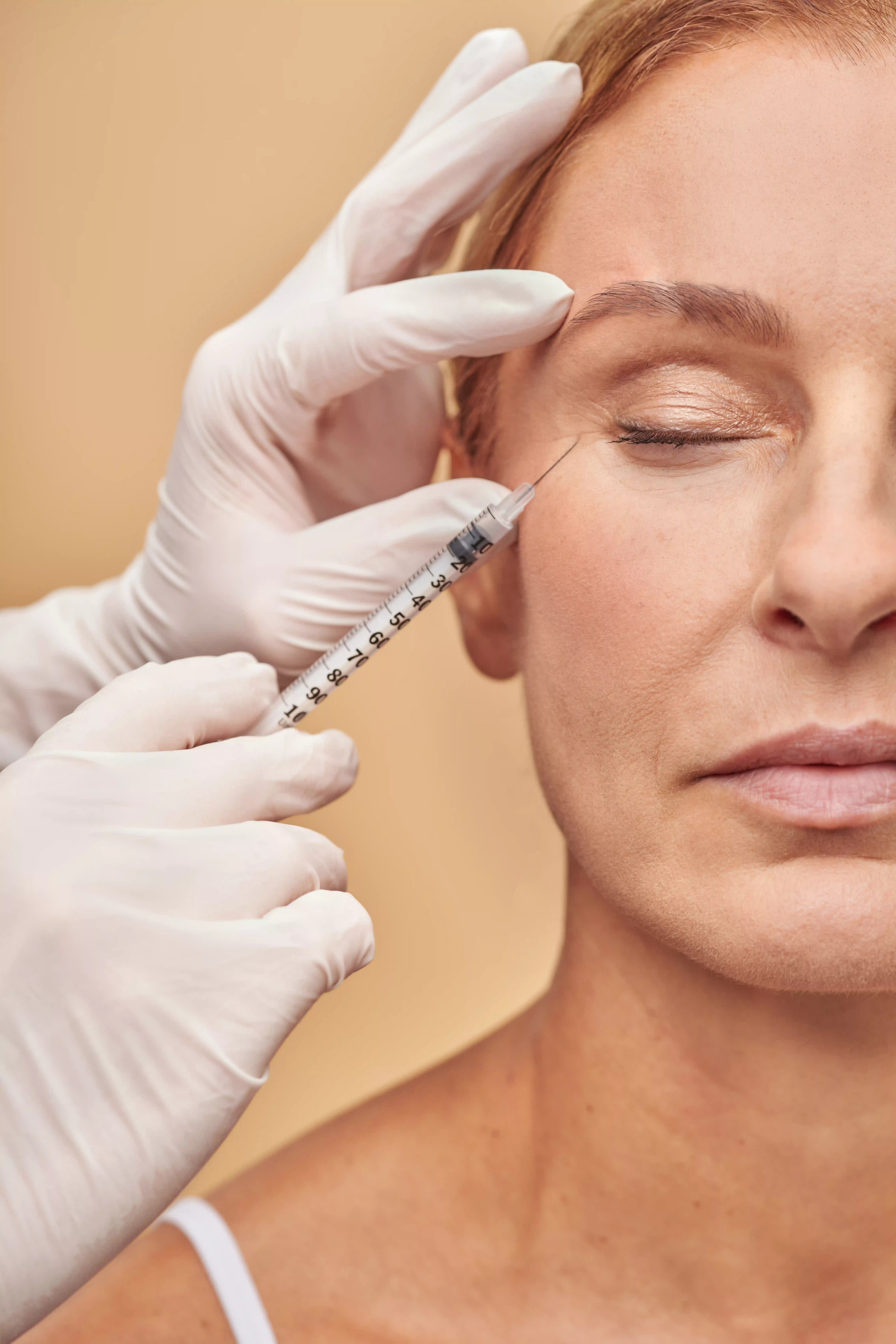 botox